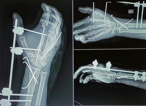 Surgeries & Treatments