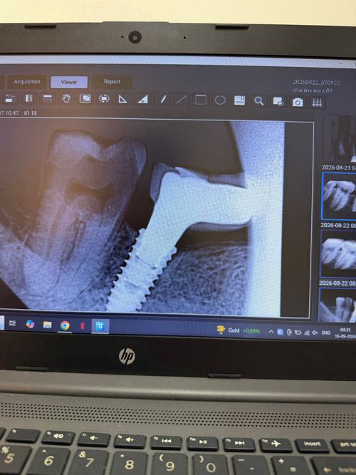 Surgeries & Treatments