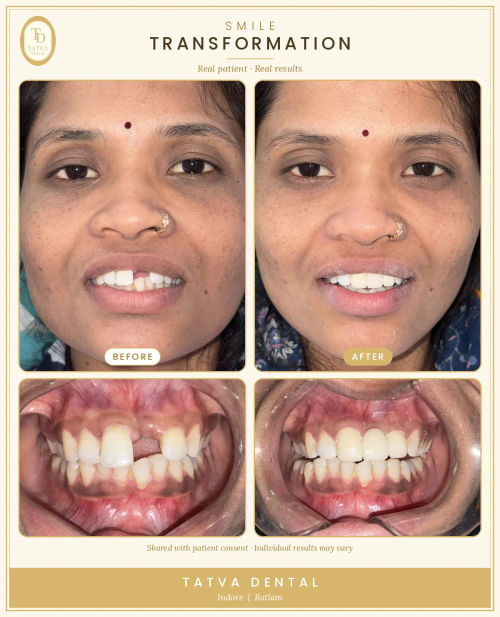 Surgeries & Treatments