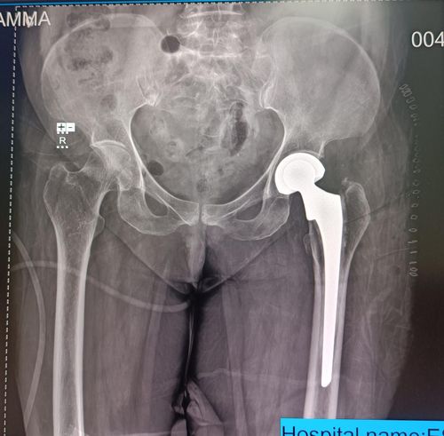 Surgeries & Treatments