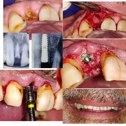 Surgeries & Treatments