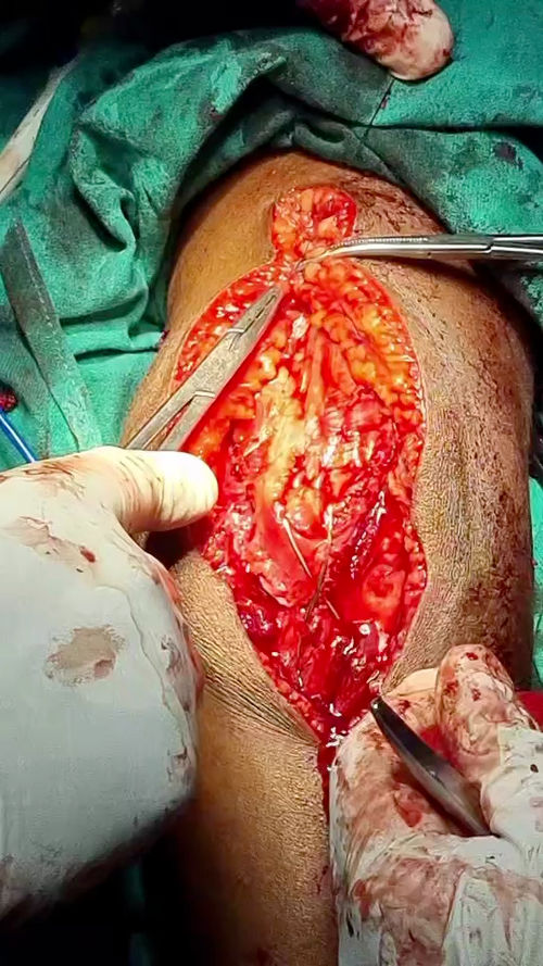 Surgeries & Treatments
