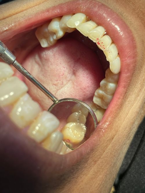 Surgeries & Treatments