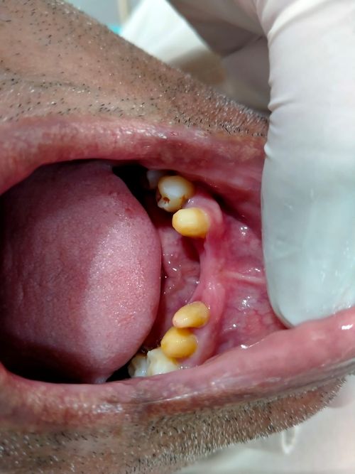Surgeries & Treatments