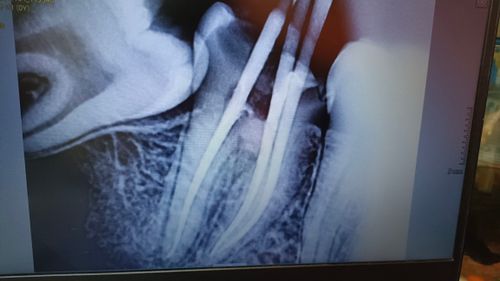 Surgeries & Treatments