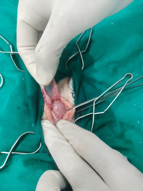 Surgeries & Treatments