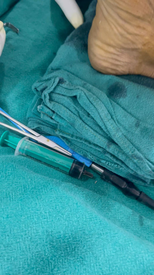 Surgeries & Treatments