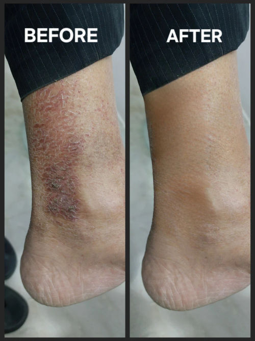 Surgeries & Treatments