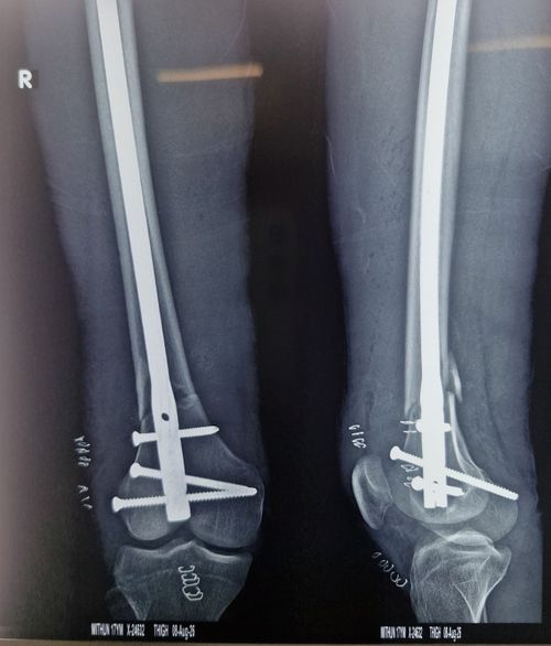 Surgeries & Treatments