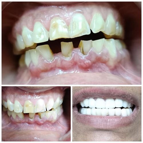 Surgeries & Treatments