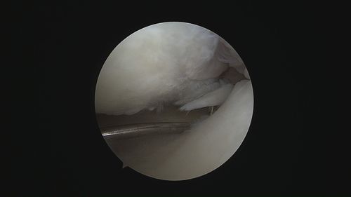 Surgeries & Treatments