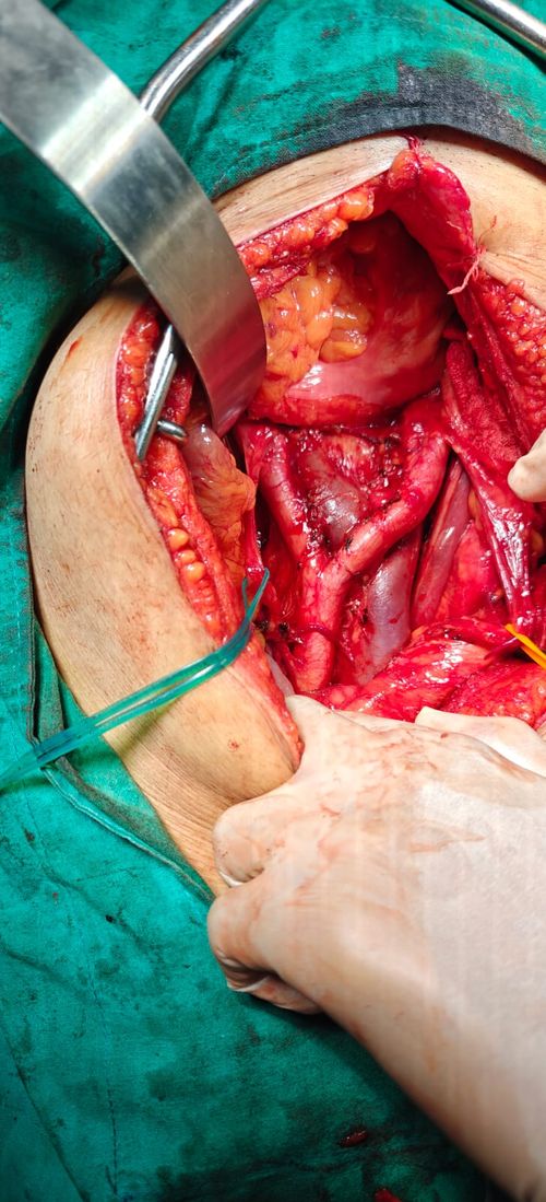 Surgeries & Treatments