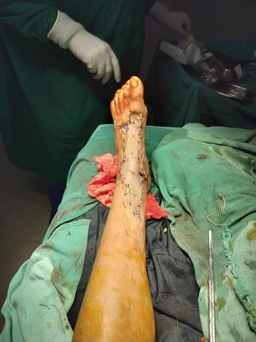 Surgeries & Treatments