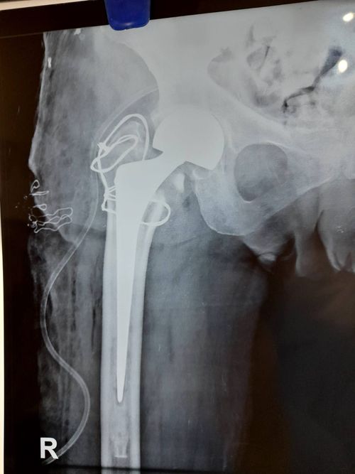 Surgeries & Treatments