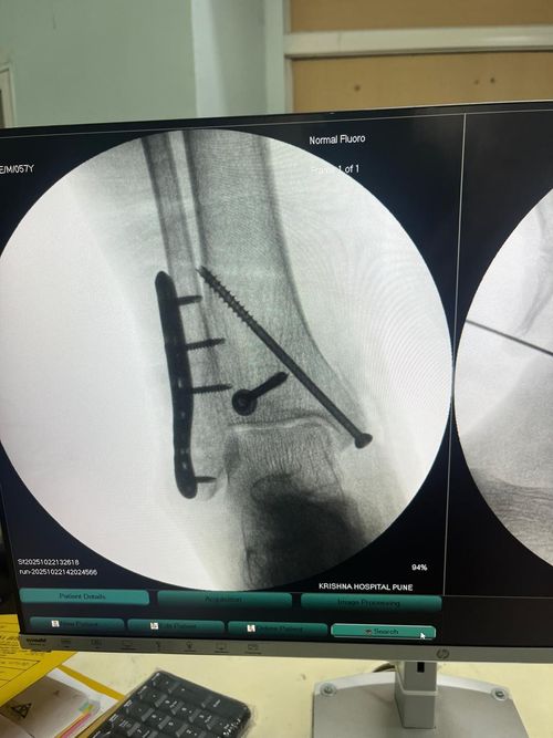 Surgeries & Treatments
