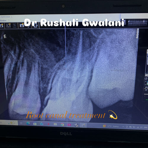Surgeries & Treatments